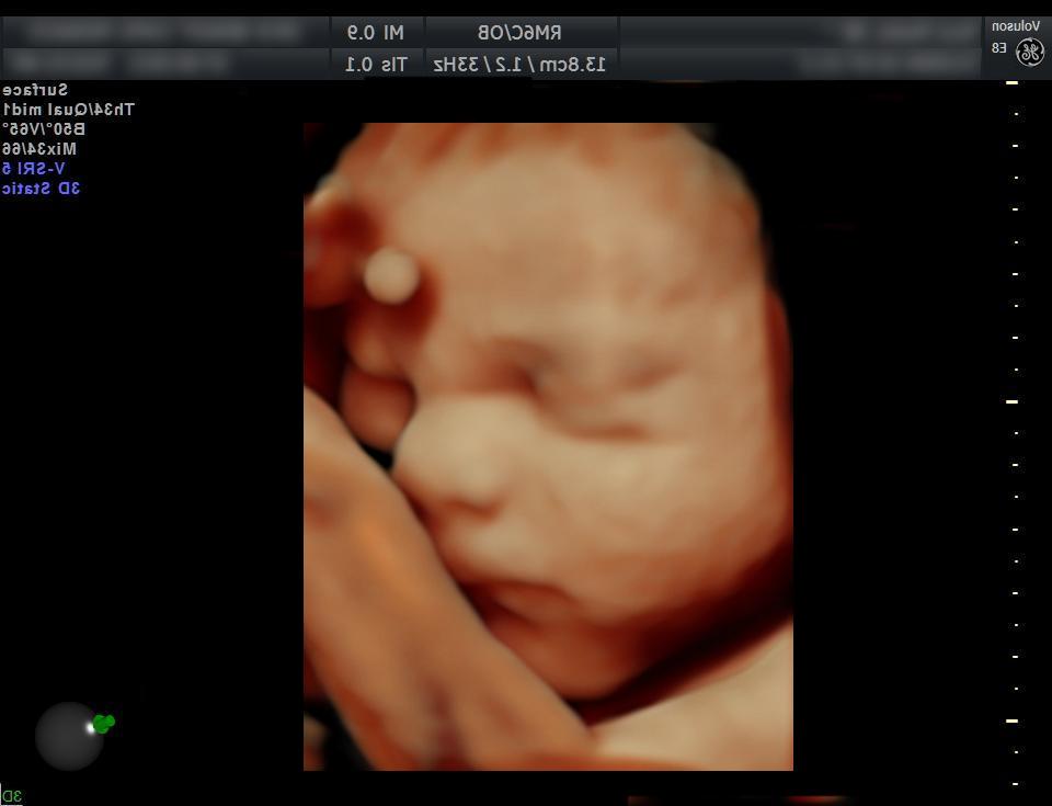 #1 Es4D Baby Scan Offer - Save £56 - 4D Scan Now Only £79