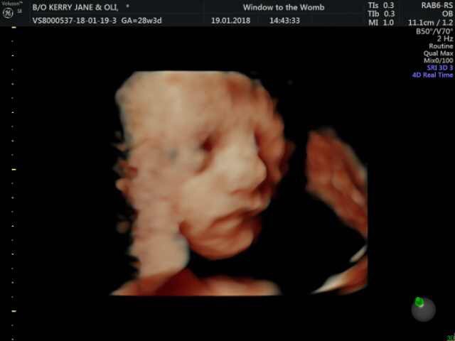 Oli Regan 4D Scan Window to the Womb