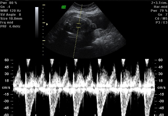 Facts About Ultrasound Scan Uncovered