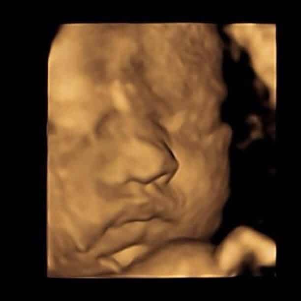 Rose & Gemma 4D Scan