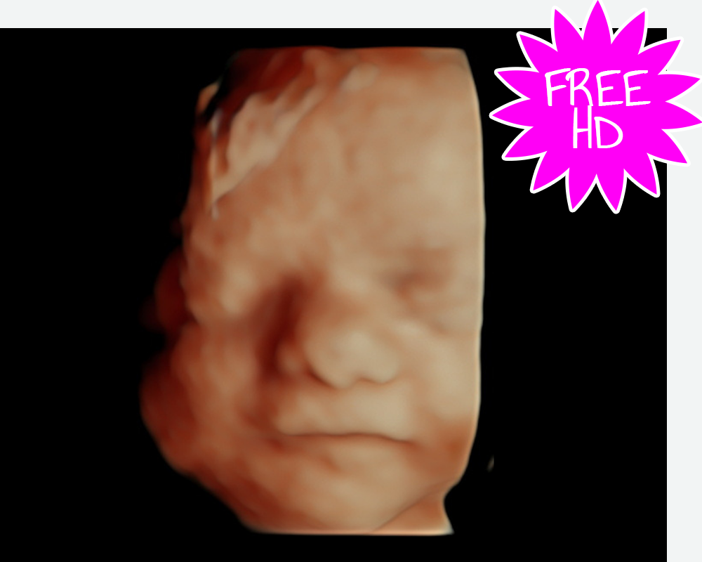 3D/4D Pregnancy Scan