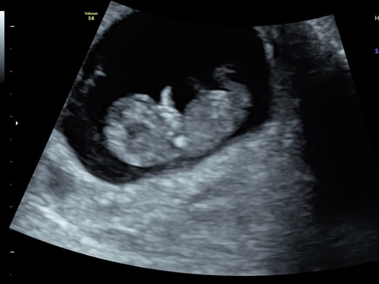 The Baby Scan Diaries