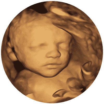 Leicester 4D Scan HD Scan Window to the Womb