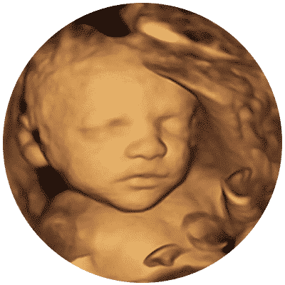 Private 3D 4D Ultrasound Scan Maidstone