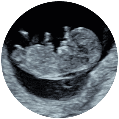 Chessington Early Ultrasound Scans