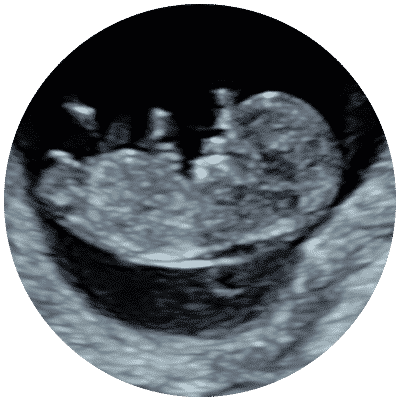 Private Early Pregnancy Ultrasound Scan Maidstone