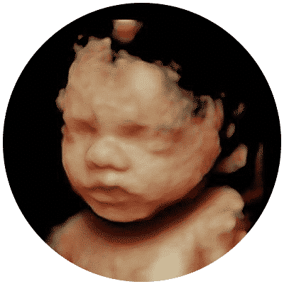 Private 3D 4D Ultrasound Scan Worthing