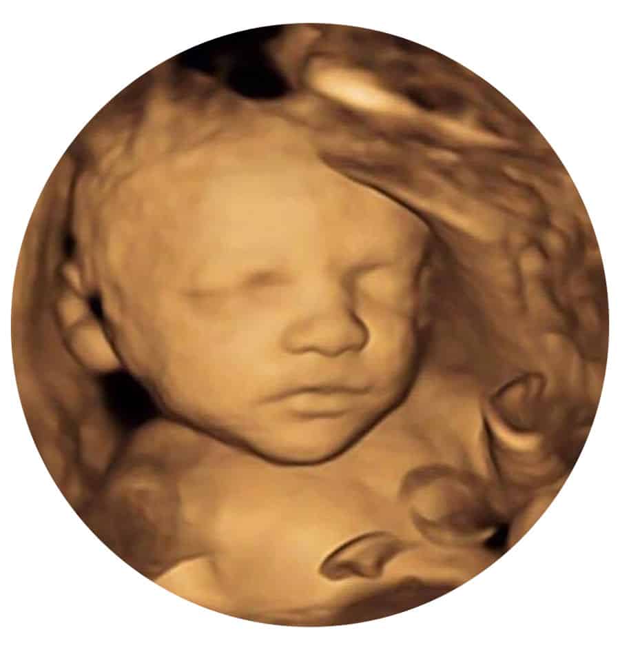 Private 4D Ultrasound Scan Bagshot, Surrey