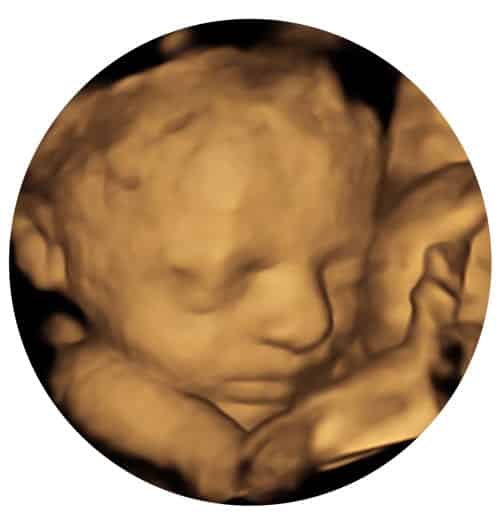 4D Scan Window to the Womb (Picture Box)