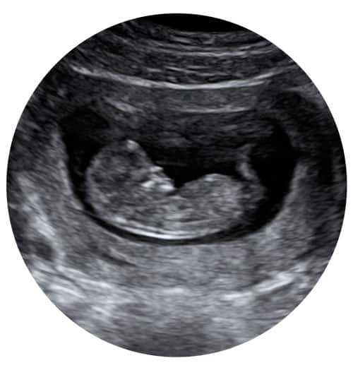 Early Pregnancy Scan Exeter Devon