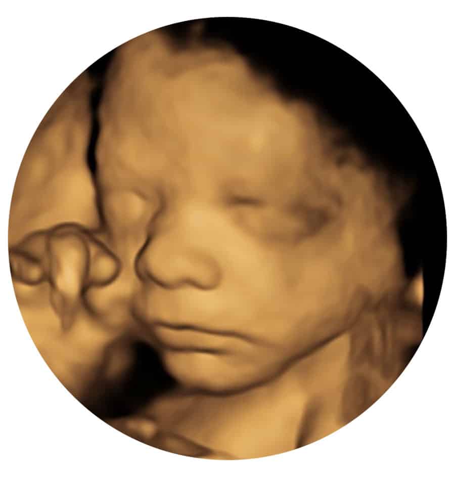 Private 3D 4D Ultrasound Scan Liverpool