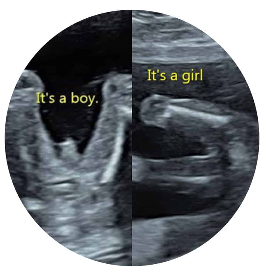 Private Gender Ultrasound Scan Ealing