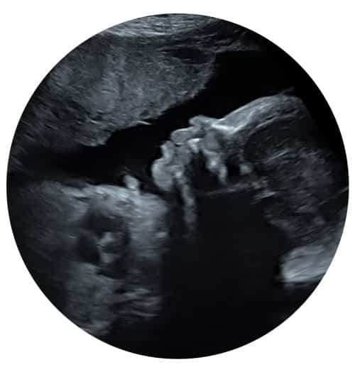 Private Well-being Scan Window to the Womb