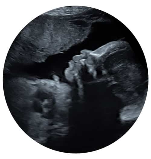 Well-being Scan from 15 Weeks Only £60 - Window to the Womb