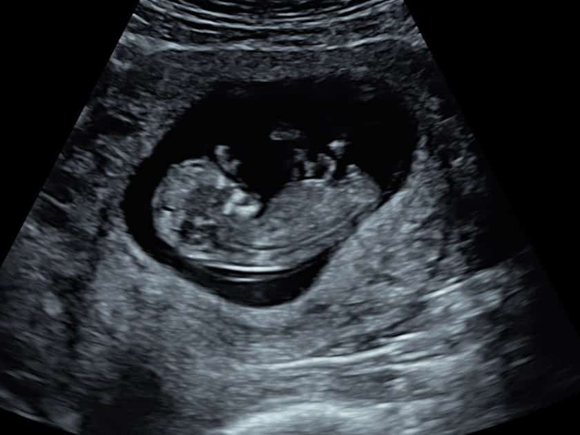 Our Early Scans Explained - to the Womb