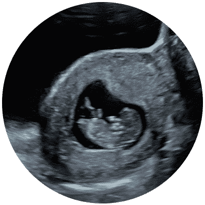 10 weeks pregnant ultrasound