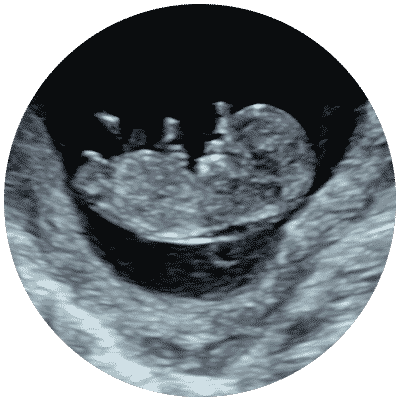 Early Scan - Reassurance Pregnancy Scan 