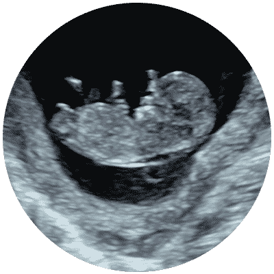 Private Early Pregnancy Ultrasound Scan Gloucester