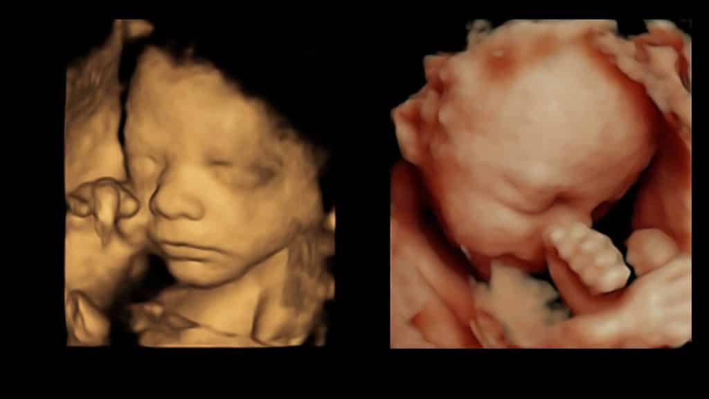 3d scan at 24 weeks pregnant